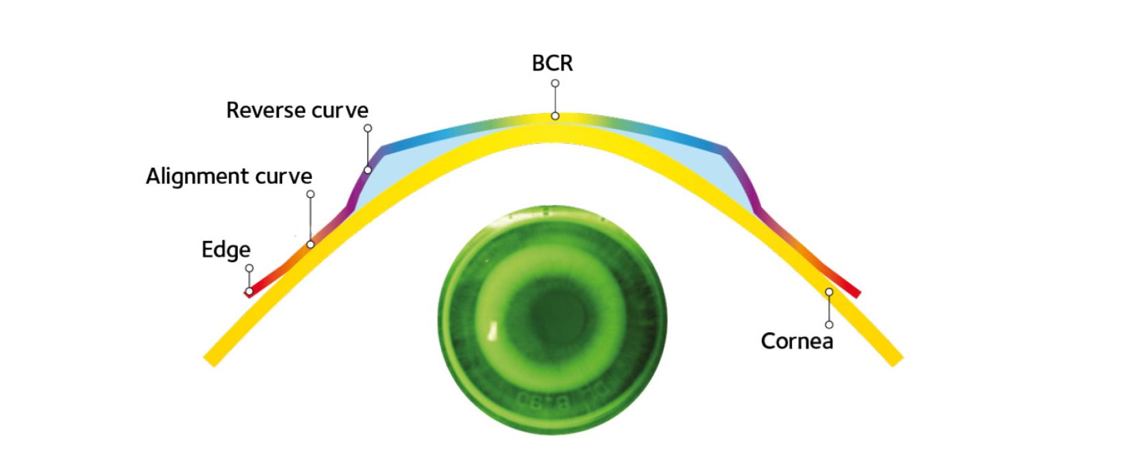 DreamLite® Nachtlinsen – Orthokeratologie (Ortho-K) zur Korrektur von Myopie (Kurzsichtigkeit) und Astigmatismus (Hornhautverkrümmung). Klare Sicht am Tag ohne Brille oder OP, reversibel, komfortabel und sicher. Myopie-Management für Kinder und Erwachsene, professionelle Anpassung durch zertifizierte Fachspezialisten, maximale Sicherheit und Sehkomfort. | Lentilles de nuit DreamLite® – Ortho-K pour corriger la myopie et l’astigmatisme. Vision claire le jour sans lunettes ni chirurgie, solution réversible et confortable. Gestion de la myopie pour enfants et adultes, adaptation par spécialistes certifiés, sécurité et confort garantis.